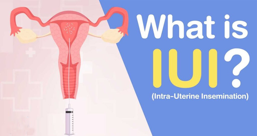 Intrauterine Insemination (IUI)