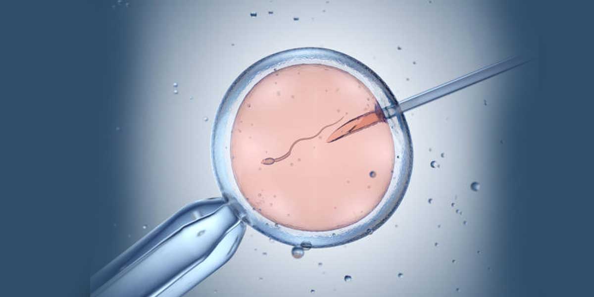 IVF